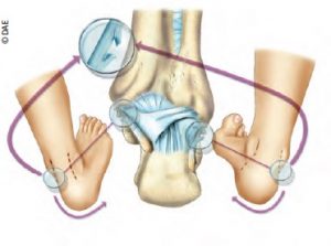 Esguince de tobillo: mecanismo de producción